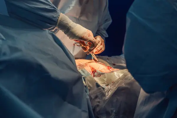 stock image Shot In Operating Room of Two Surgeons During the Surgery Procedure Bending Over Patient with Instruments. Professional Doctors in Modern Hospital