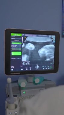 Ultrason makinesinin ekranında hamileliğin son evrelerinde bir bebek görülüyor. Gelişmiş fetal gelişim ve doğum öncesi sağlık izleme. Hamilelik, sağlık teknolojisi ve annelik sağlığı kavramı..