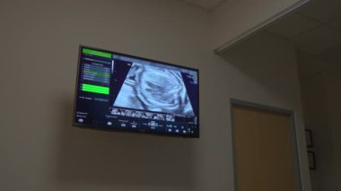 Ultrason makinesinin ekranında hamileliğin son evrelerinde bir bebek görülüyor. Gelişmiş fetal gelişim ve doğum öncesi sağlık izleme. Hamilelik, sağlık teknolojisi ve annelik sağlığı kavramı..