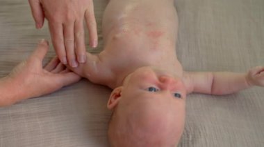 Bir anne yeni doğan bebeğinin hassas cildini tedavi etmek için nazikçe krem sürer. Şefkatli ve şefkatli bir an, bebek tenini sevgi ve dikkatle dindirmeye ve iyileştirmeye odaklandı..