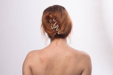 Deri dokusu. Sırtında sivilce var. Cilt tedavisi. Cilt bakımı sorunu. Sivilceler ve doğal deri. Deri bakımı konsepti. Sivilce tedavisi. Yüzünde sivilceler. Sivilce ve sivilce. Sivilce arka planı