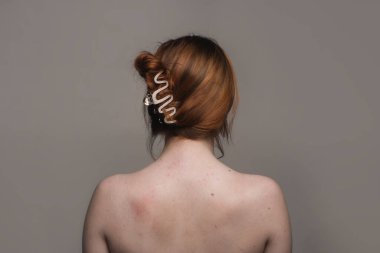 Deri dokusu. Sırtında sivilce var. Cilt tedavisi. Cilt bakımı sorunu. Sivilceler ve doğal deri. Deri bakımı konsepti. Sivilce tedavisi. Yüzünde sivilceler. Sivilce ve sivilce. Sivilce arka planı