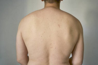 30 yaşında orta yapılı bir adamın sırtı ve sırtı.