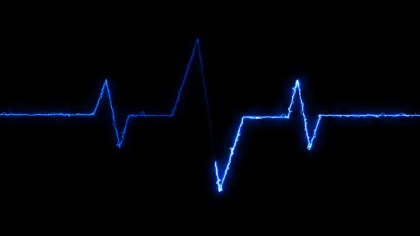 Швидкість Серцебиття Анімація Сигналу Імпульсної Хвилі Rs_1506 Переглядів — стокове відео