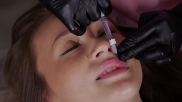 Inyectar Relleno Labio Superior Joven Mujer Bonita Con Cara Muñeca — Vídeos de Stock