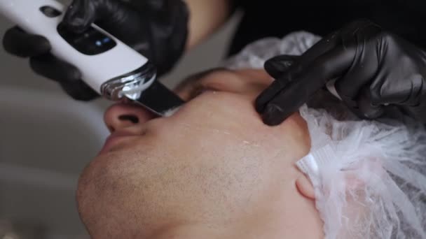 Kosmetolog Czyści Skórę Twarzy Człowieka Pomocą Płuczki Ultradźwiękowej Środek Strzału — Wideo stockowe