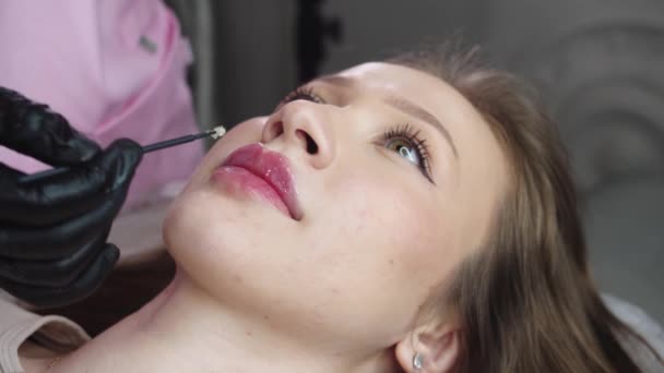Lippenfüllungsverfahren Schmerzmittel Auf Die Lippen Einer Schönen Jungen Frau Auftragen — Stockvideo