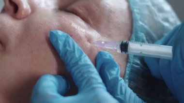 Kozmetik tedavisi. Yaşlı bir kadın için güzellik iğneleri. Orta çekim