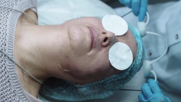 Cosmetologische Behandeling Arts Zet Beschermende Schijven Ogen Van Patiënten Voor — Stockvideo