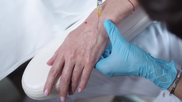 女性の手の皮膚の下に美容注射 ミッドショット — ストック動画