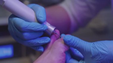 Kadın bir hasta için pedikür. Baş parmağındaki tırnağı mekanik bir aletle temizliyor. Orta çekim