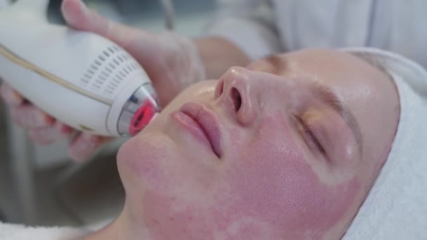 Cosmetologia Limpeza Facial Vácuo Para Uma Jovem Mulher Pele Vermelha — Vídeo de Stock