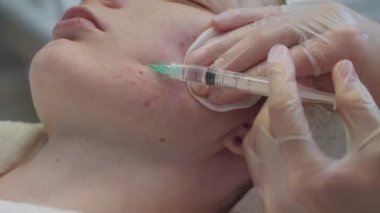 Bir dermatologla seans. Terapist derinin altına bir solüsyon enjekte ediyor. Orta çekim