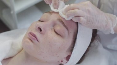 Bir güzellik uzmanı genç bir bayan müşterinin çilli yüzünü siliyor. Orta çekim