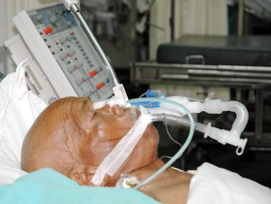 Hastanedeki hasta, bhopal, madhya pradesh, Hindistan, Asya