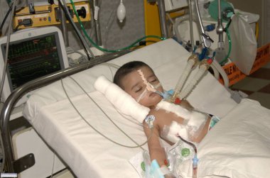 Dr. N. Padmanabhan sınırında tedavi gören çocuk, Chennai, Tamil Nadu, Hindistan  
