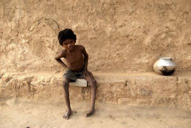 Çocuk felci kırsal çocuğu, Rajouli 'yi, Nawada' yı, Bihar 'ı, Hindistan' ı etkiledi.