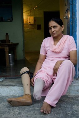 Tacizci bayan Anita şimdi Jaipur ayağını kullanarak kazada bacağını kaybetti. 