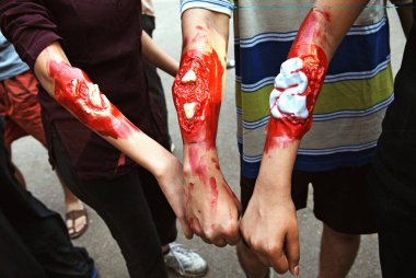 Students of KEM medical college showing injuries before emergency rescue demonstration in Bombay Mumbai, Maharashtra, India 18-February-2009  clipart