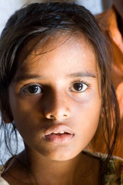 Malvani gecekondu mahallesinde, Malad, Bombay Mumbai, Maharashtra, Hindistan 'da bir kızın yüzü    