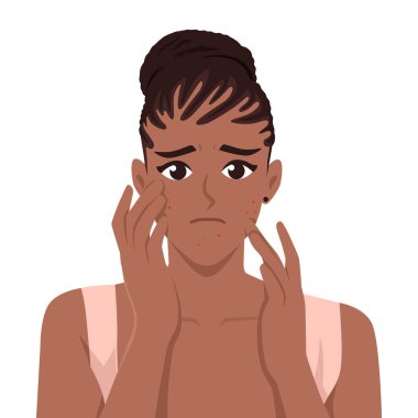 Sivilce ve cilt sorunları yüzünden endişelenen genç bir kadın. Düz vektör Karakteri Çizimi