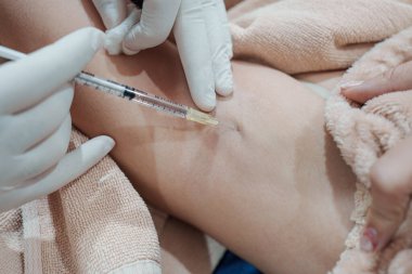 Cilt bakterisi kliniğinde vücut kokusunu ve kırışıklıkları azaltmak için koltukaltına şırınga bakteriyel botulin enjekte eden bir tıp uzmanının yakınlaşması.