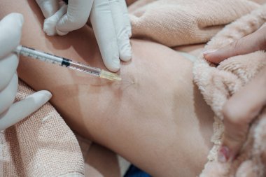 Cilt bakterisi kliniğinde vücut kokusunu ve kırışıklıkları azaltmak için koltukaltına şırınga bakteriyel botulin enjekte eden bir tıp uzmanının yakınlaşması.