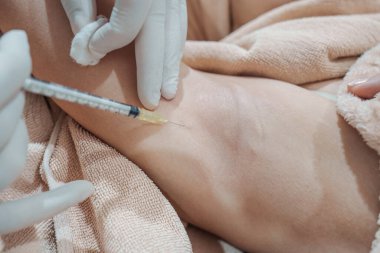 Cilt bakterisi kliniğinde vücut kokusunu ve kırışıklıkları azaltmak için koltukaltına şırınga bakteriyel botulin enjekte eden bir tıp uzmanının yakınlaşması.