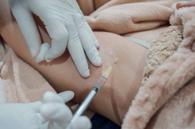 Cilt bakterisi kliniğinde vücut kokusunu ve kırışıklıkları azaltmak için koltukaltına şırınga bakteriyel botulin enjekte eden bir tıp uzmanının yakınlaşması.