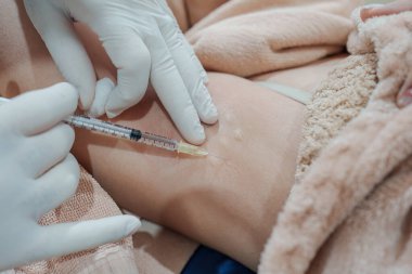 Cilt bakterisi kliniğinde vücut kokusunu ve kırışıklıkları azaltmak için koltukaltına şırınga bakteriyel botulin enjekte eden bir tıp uzmanının yakınlaşması.