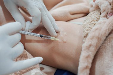 Cilt bakterisi kliniğinde vücut kokusunu ve kırışıklıkları azaltmak için koltukaltına şırınga bakteriyel botulin enjekte eden bir tıp uzmanının yakınlaşması.