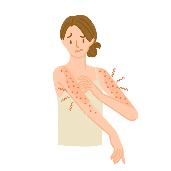 stock vector A woman whose arm skin is rough, inflamed, and itchy due to an allergic reaction.