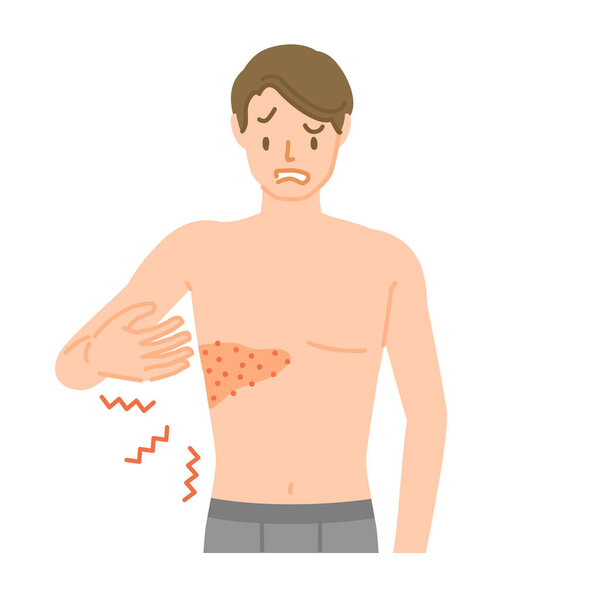 Shingles: Men who experience pain, itching, and swelling from the chest to the back