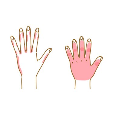 Soğuğun oluştuğu ortak alanların resmedilmesi (yetişkin ve çocuk elleri)