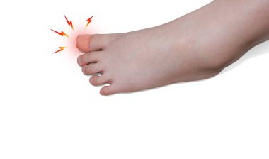 Yaralı ayak parmağı bandajlı, yaraları iyileşmiş, beyaz C 'de izole edilmiş.