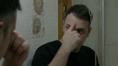 Genç bir adam banyoda yüzüne terapötik sivilce kremi sürüyor. Yüzünde sivilce olan bir adam aynanın önünde akne tedavi kremi sürüyor.