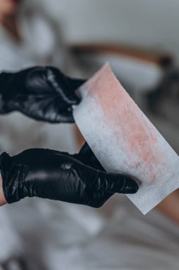 Kadın bacakları alındıktan sonraki görüntüler. Yüksek kalite fotoğraf