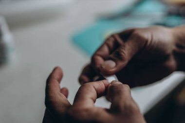 Adam mutfakta yemek pişirirken parmağını kesmiş, yakın plan. Yüksek kalite fotoğraf