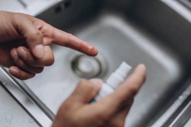 Adam mutfakta yemek pişirirken parmağını kesmiş, yakın plan. Yüksek kalite fotoğraf