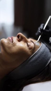 Orta yaşlı bir kadın kozmetik kliniğinde yaşlanma karşıtı yüz soyma tedavisi görüyor.