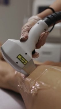 Düz cilt için kadın bacaklarında diyot lazer ameliyatı. Klinikte güzellik uzmanı tedavisi görüyor.