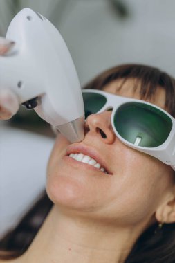 Profesyonel kozmetik uzmanı koruyucu gözlük takan bir kadına yüz lazeri ameliyatı yapıyor. Yüksek kalite fotoğraf