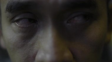 Sinirli kırmızı kan gözü kılcal ağ alerjisi ile dolu. Yakın plan, tıbbi ve sinematik kamera görüntüleri göz sahnesinde..