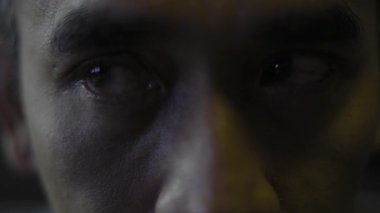 Sinirli kırmızı kan gözü kılcal ağ alerjisi ile dolu. Yakın plan, tıbbi ve sinematik kamera görüntüleri göz sahnesinde..