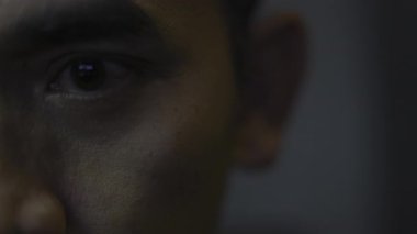 Sinirli kırmızı kan gözü kılcal ağ alerjisi ile dolu. Yakın plan, tıbbi ve sinematik kamera görüntüleri göz sahnesinde..