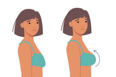 Kadın göğüsleri için estetik ameliyat yaptırmış. Boyutunu arttırmak ya da dayanıklılığını arttırmak için implant taktırmış. Göğüs ameliyatından önce ve sonra iki kızın karşılaştırılması ve sarkık meme uçlarının kaldırılması.