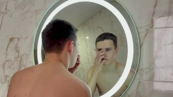 Nešťastný Teenager Podívá Zrcadla Dotýká Pupínků — Stock video