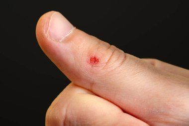 Küçük kanlı bir sıyrık. Adamın yaralı parmağı. Yaralı parmak. Deride bir çizik. Görüntüyü kapat.
