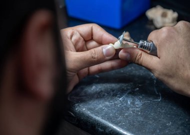 İnsan ağzının içine tıkanma sırasında diş testeresi takmak için.