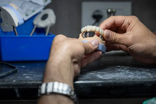 stock image Dental gypsum models in dental laboratory with single tooth crown to be tested for Teeth occlude correctly